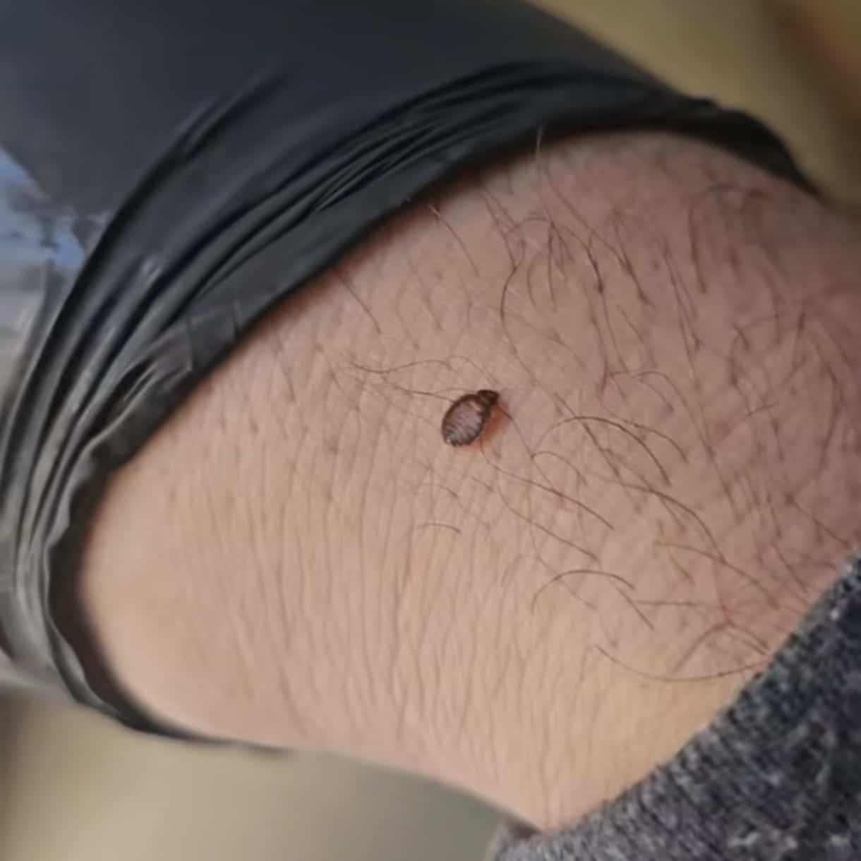 مكافحة البق